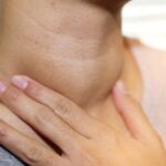 Penyakit Mumps Sedang Mengincar